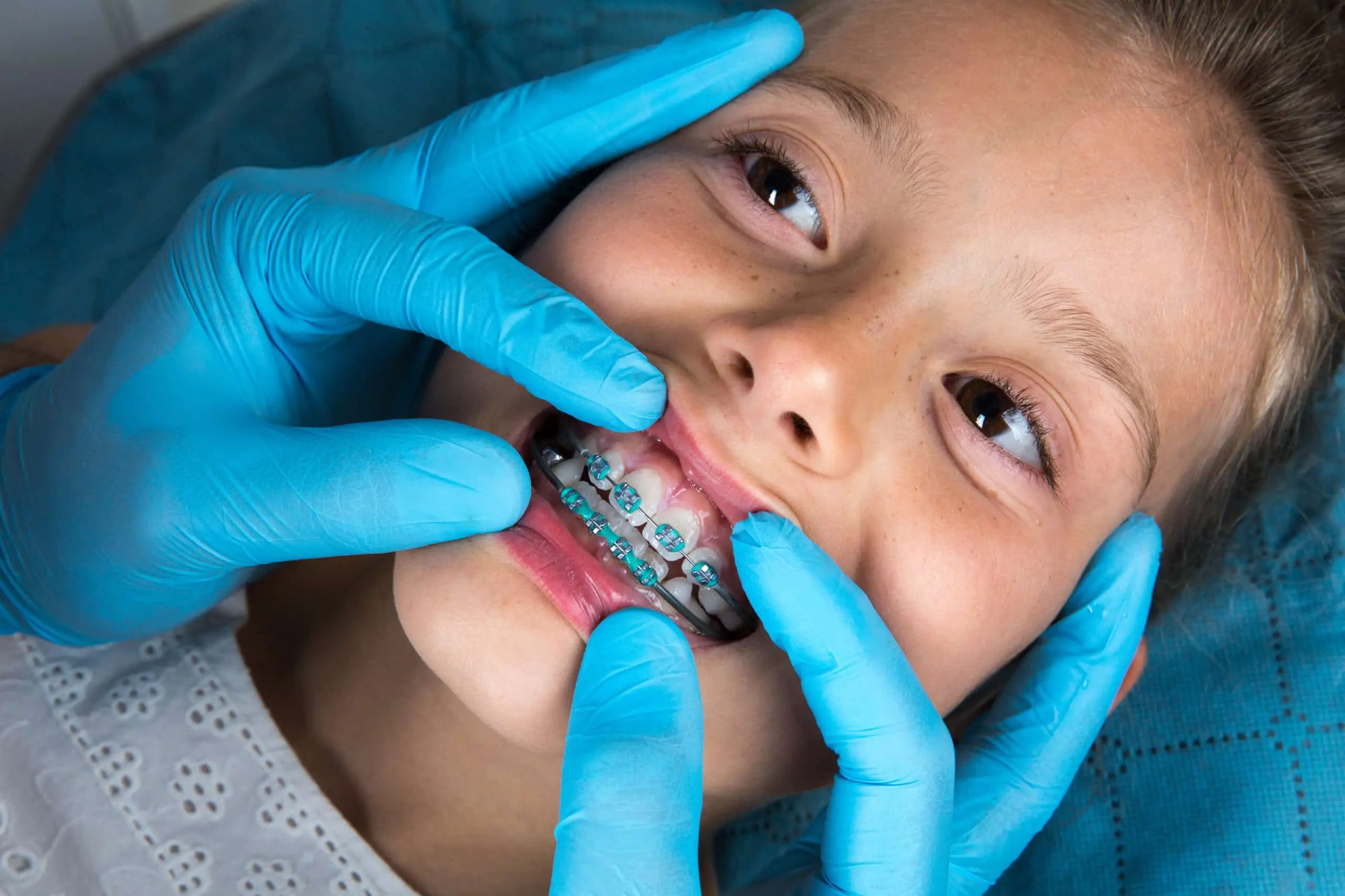 Early Orthodontic Assessment for Children