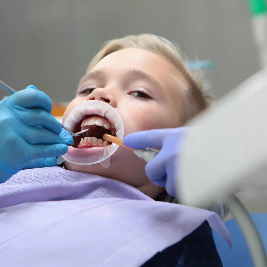 Fluoride Treatment for Children