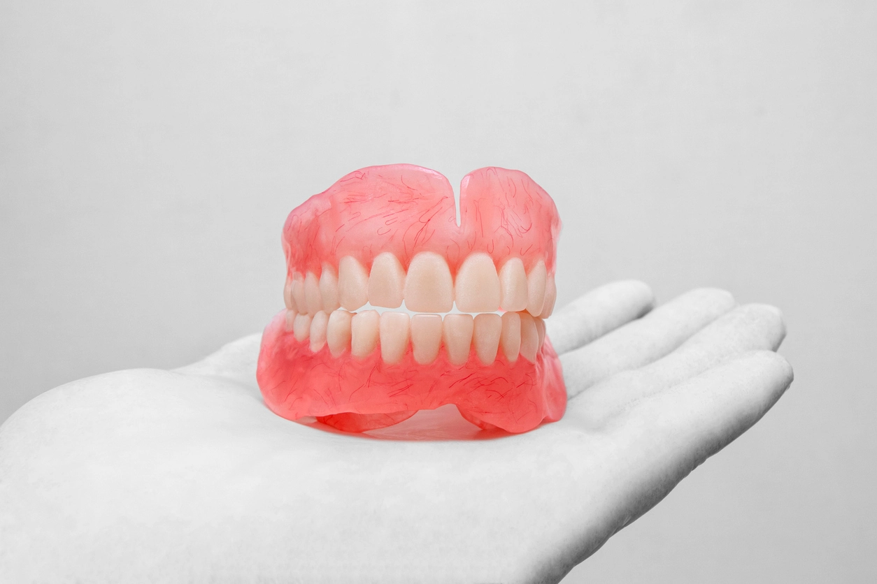 Full Mouth Rehabilitation in Noida