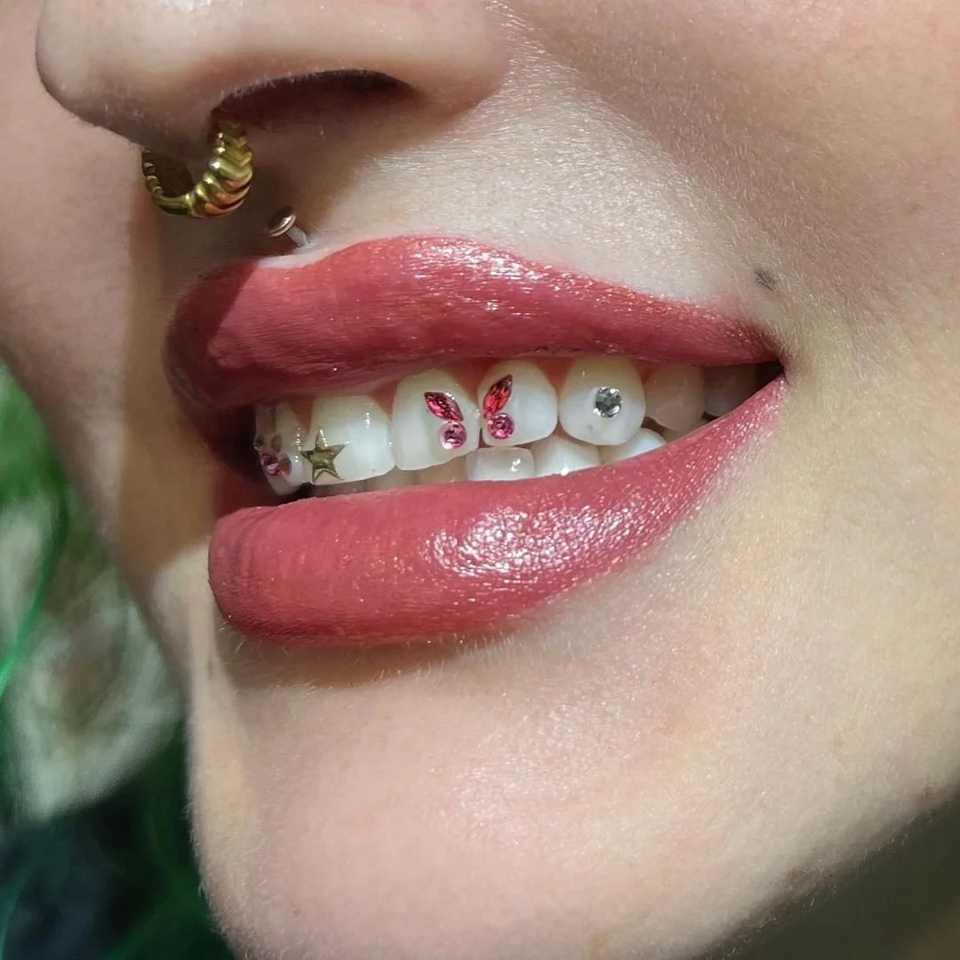 Dental Jewellery in Sector 104 Noida